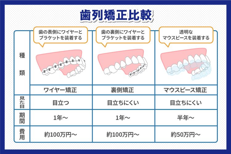 歯列矯正比較