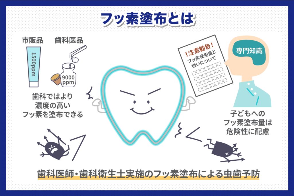 フッ素塗布とは