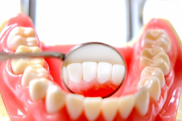歯周病治療とはどんな治療なのか？
